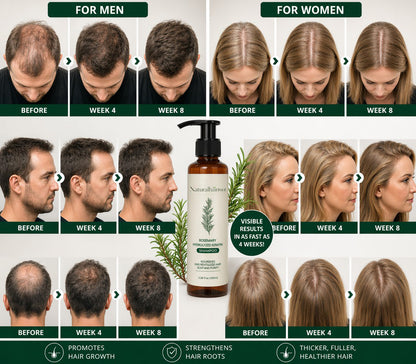 🌿 Rosemary Hair Growth Shampoo
