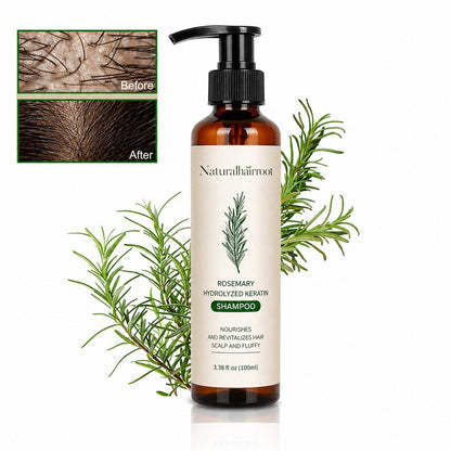 🌿 Rosemary Hair Growth Shampoo