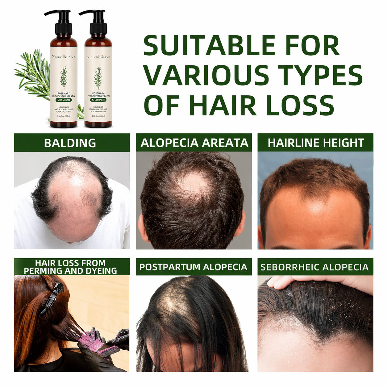 🌿 Rosemary Hair Growth Shampoo