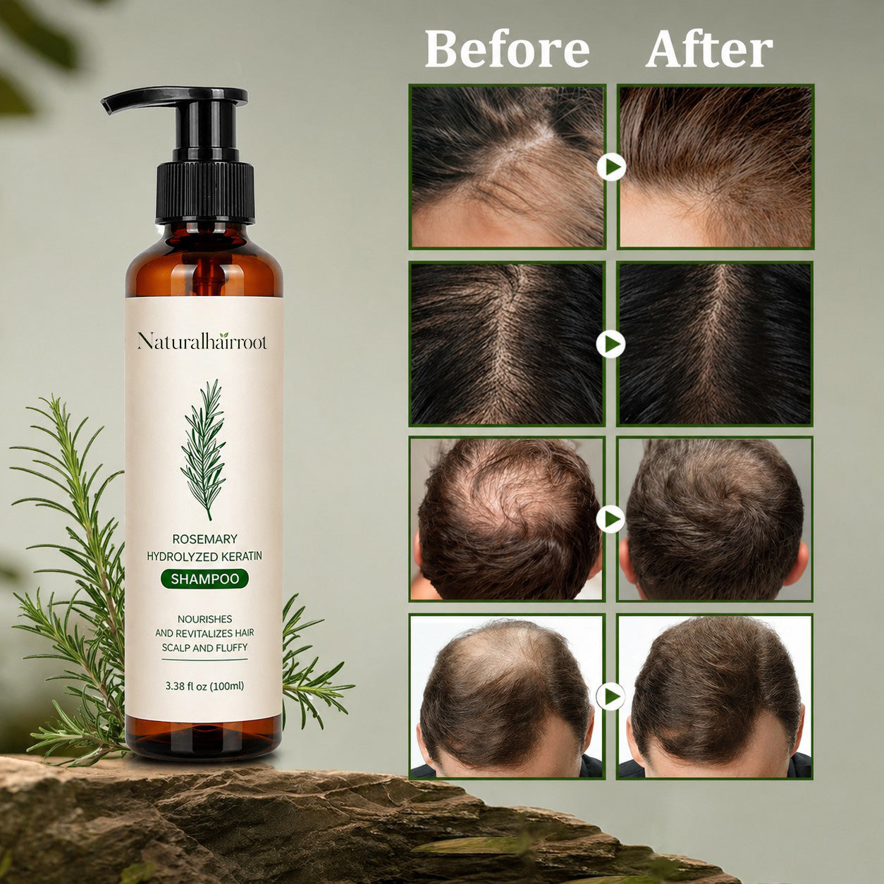 🌿 Rosemary Hair Growth Shampoo