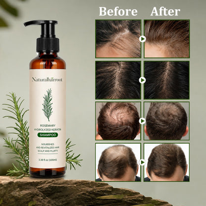 🌿 Rosemary Hair Growth Shampoo